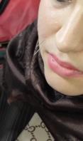 آموزش طب سوزنی