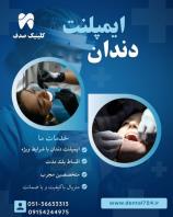 ایمپلنت دندان در مشهد، از دم قسط، بدون سود و بهره